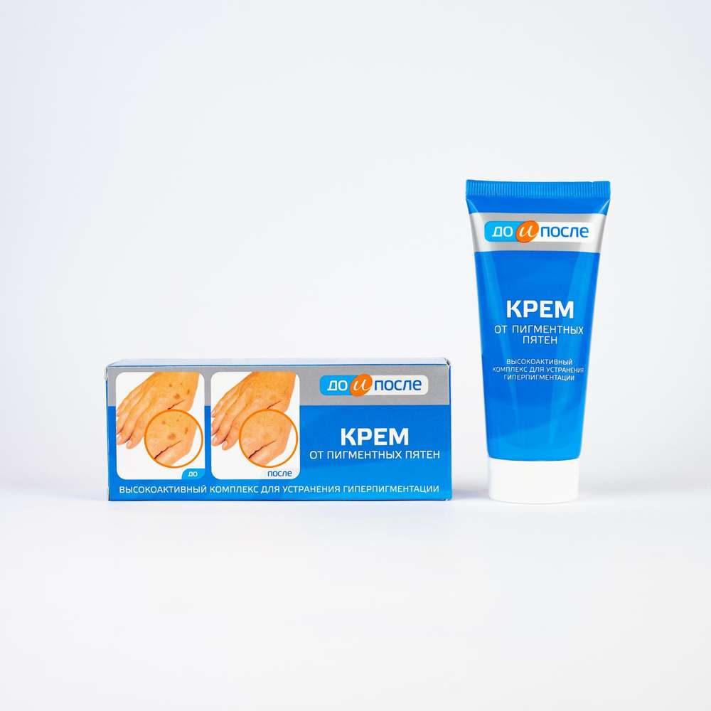 Cream For Age Spots Before And After 